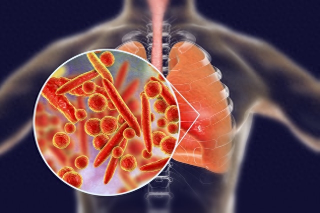 肺炎支原体感染“大年”，支原体“横行”全国，儿童高发期到来！